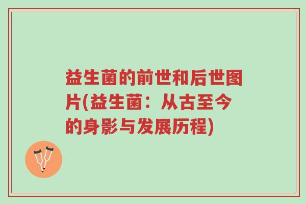益生菌的前世和后世图片(益生菌:从古至今的身影与发展历程)-第1张图片-超越 益生菌的前世和后世图片(益生菌:从古至今的身影与发展历程)-第1张图片-超越