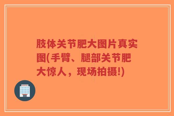 肢体关节肥大图片真实图(手臂、腿部关节肥大惊人,现场拍摄!)-第1张图片-超越 肢体关节肥大图片真实图(手臂、腿部关节肥大惊人,现场拍摄!)-第1张图片-超越
