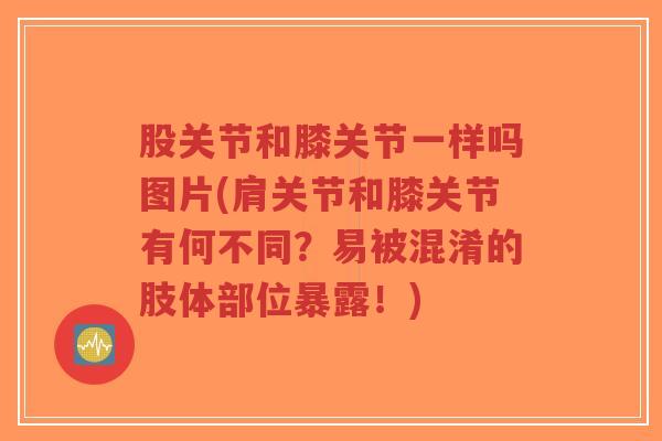 股关节和膝关节一样吗图片(肩关节和膝关节有何不同?易被混淆的肢体部位暴露!)-第1张图片-超越 股关节和膝关节一样吗图片(肩关节和膝关节有何不同?易被混淆的肢体部位暴露!)-第1张图片-超越