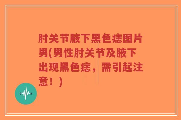 肘关节腋下黑色痣图片男(男性肘关节及腋下出现黑色痣,需引起注意!)-第1张图片-超越 肘关节腋下黑色痣图片男(男性肘关节及腋下出现黑色痣,需引起注意!)-第1张图片-超越