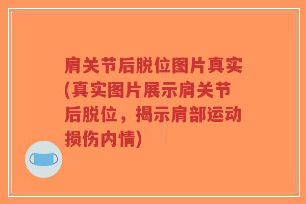 肩关节后脱位图片真实(真实图片展示肩关节后脱位,揭示肩部运动损伤内情)-第1张图片-超越 肩关节后脱位图片真实(真实图片展示肩关节后脱位,揭示肩部运动损伤内情)-第1张图片-超越
