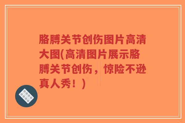 胳膊关节创伤图片高清大图(高清图片展示胳膊关节创伤,惊险不逊真人秀!)-第1张图片-超越 胳膊关节创伤图片高清大图(高清图片展示胳膊关节创伤,惊险不逊真人秀!)-第1张图片-超越