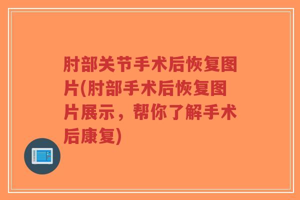 肘部关节手术后恢复图片(肘部手术后恢复图片展示,帮你了解手术后康复)-第1张图片-超越 肘部关节手术后恢复图片(肘部手术后恢复图片展示,帮你了解手术后康复)-第1张图片-超越