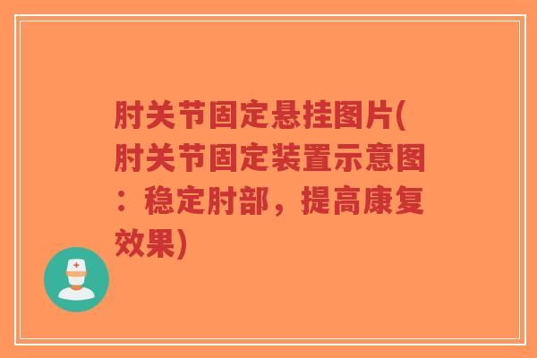 肘关节固定悬挂图片(肘关节固定装置示意图:稳定肘部,提高康复效果)-第1张图片-超越 肘关节固定悬挂图片(肘关节固定装置示意图:稳定肘部,提高康复效果)-第1张图片-超越