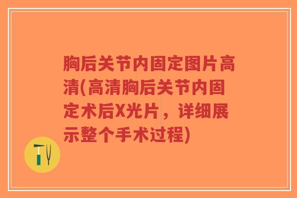 胸后关节内固定图片高清(高清胸后关节内固定术后X光片,详细展示整个手术过程)-第1张图片-超越 胸后关节内固定图片高清(高清胸后关节内固定术后X光片,详细展示整个手术过程)-第1张图片-超越