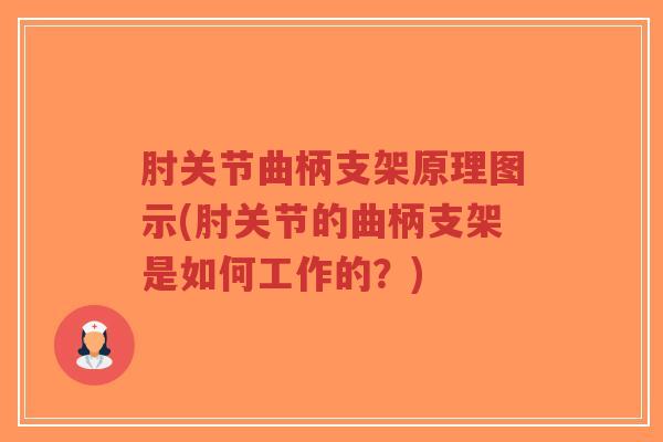 肘关节曲柄支架原理图示(肘关节的曲柄支架是如何工作的?)-第1张图片-超越 肘关节曲柄支架原理图示(肘关节的曲柄支架是如何工作的?)-第1张图片-超越