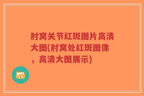 肘窝关节红斑图片高清大图(肘窝处红斑图像,高清大图展示)-第1张图片-超越 肘窝关节红斑图片高清大图(肘窝处红斑图像,高清大图展示)-第1张图片-超越