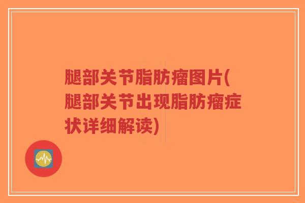 腿部关节脂肪瘤图片(腿部关节出现脂肪瘤症状详细解读)-第1张图片-超越 腿部关节脂肪瘤图片(腿部关节出现脂肪瘤症状详细解读)-第1张图片-超越