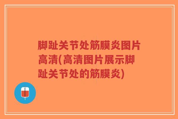 脚趾关节处筋膜炎图片高清(高清图片展示脚趾关节处的筋膜炎)-第1张图片-超越 脚趾关节处筋膜炎图片高清(高清图片展示脚趾关节处的筋膜炎)-第1张图片-超越