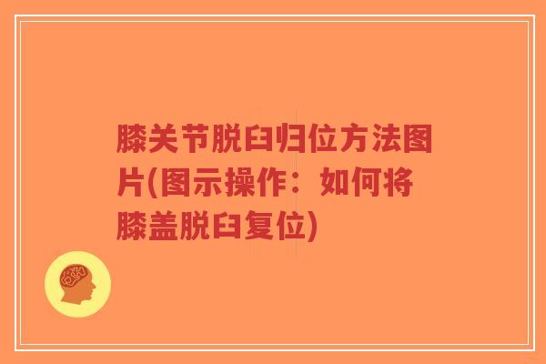 膝关节脱臼归位方法图片(图示操作:如何将膝盖脱臼复位)-第1张图片-超越 膝关节脱臼归位方法图片(图示操作:如何将膝盖脱臼复位)-第1张图片-超越