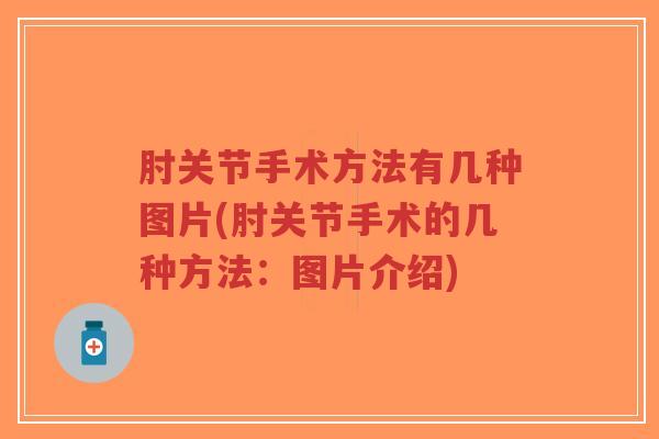 肘关节手术方法有几种图片(肘关节手术的几种方法:图片介绍)-第1张图片-超越 肘关节手术方法有几种图片(肘关节手术的几种方法:图片介绍)-第1张图片-超越