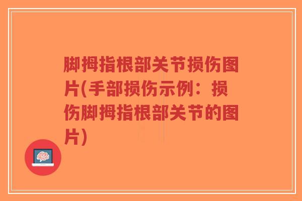 脚拇指根部关节损伤图片(手部损伤示例:损伤脚拇指根部关节的图片)-第1张图片-超越 脚拇指根部关节损伤图片(手部损伤示例:损伤脚拇指根部关节的图片)-第1张图片-超越