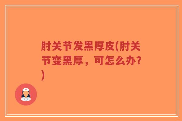 肘关节发黑厚皮(肘关节变黑厚,可怎么办?)-第1张图片-超越 肘关节发黑厚皮(肘关节变黑厚,可怎么办?)-第1张图片-超越