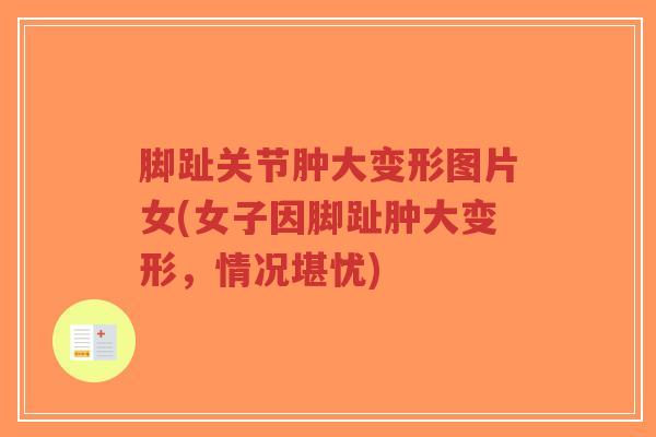 脚趾关节肿大变形图片女(女子因脚趾肿大变形,情况堪忧)-第1张图片-超越 脚趾关节肿大变形图片女(女子因脚趾肿大变形,情况堪忧)-第1张图片-超越
