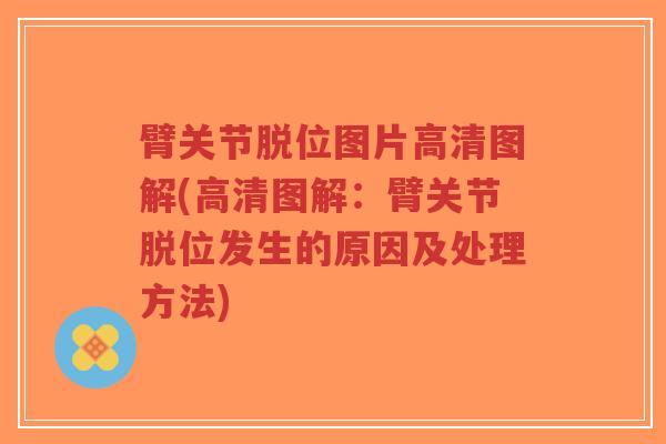 臂关节脱位图片高清图解(高清图解:臂关节脱位发生的原因及处理方法)-第1张图片-超越 臂关节脱位图片高清图解(高清图解:臂关节脱位发生的原因及处理方法)-第1张图片-超越