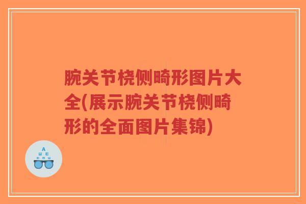 腕关节桡侧畸形图片大全(展示腕关节桡侧畸形的全面图片集锦)-第1张图片-超越 腕关节桡侧畸形图片大全(展示腕关节桡侧畸形的全面图片集锦)-第1张图片-超越