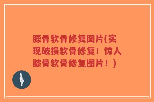 膝骨软骨修复图片(实现破损软骨修复!惊人膝骨软骨修复图片!)-第1张图片-超越 膝骨软骨修复图片(实现破损软骨修复!惊人膝骨软骨修复图片!)-第1张图片-超越