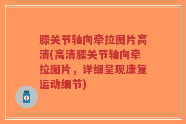 膝关节轴向牵拉图片高清(高清膝关节轴向牵拉图片,详细呈现康复运动细节)-第1张图片-超越 膝关节轴向牵拉图片高清(高清膝关节轴向牵拉图片,详细呈现康复运动细节)-第1张图片-超越