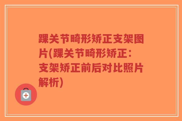 踝关节畸形矫正支架图片(踝关节畸形矫正:支架矫正前后对比照片解析)-第1张图片-超越 踝关节畸形矫正支架图片(踝关节畸形矫正:支架矫正前后对比照片解析)-第1张图片-超越
