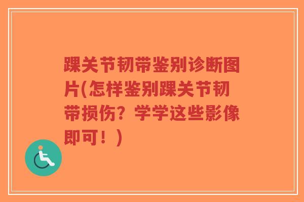 踝关节韧带鉴别诊断图片(怎样鉴别踝关节韧带损伤?学学这些影像即可!)-第1张图片-超越 踝关节韧带鉴别诊断图片(怎样鉴别踝关节韧带损伤?学学这些影像即可!)-第1张图片-超越