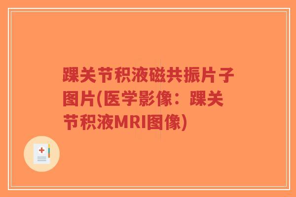 踝关节积液磁共振片子图片(医学影像：踝关节积液MRI图像)-第1张图片-超越