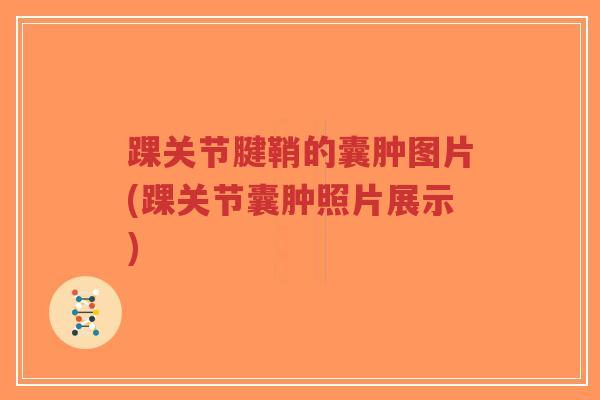 踝关节腱鞘的囊肿图片(踝关节囊肿照片展示)-第1张图片-超越 踝关节腱鞘的囊肿图片(踝关节囊肿照片展示)-第1张图片-超越