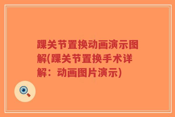 踝关节置换动画演示图解(踝关节置换手术详解:动画图片演示)-第1张图片-超越 踝关节置换动画演示图解(踝关节置换手术详解:动画图片演示)-第1张图片-超越