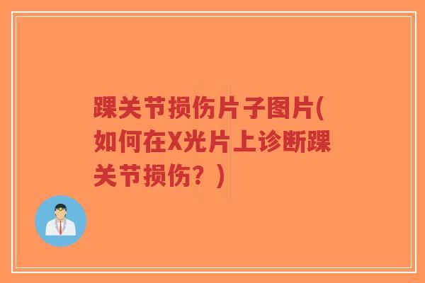 踝关节损伤片子图片(如何在X光片上诊断踝关节损伤?)-第1张图片-超越 踝关节损伤片子图片(如何在X光片上诊断踝关节损伤?)-第1张图片-超越
