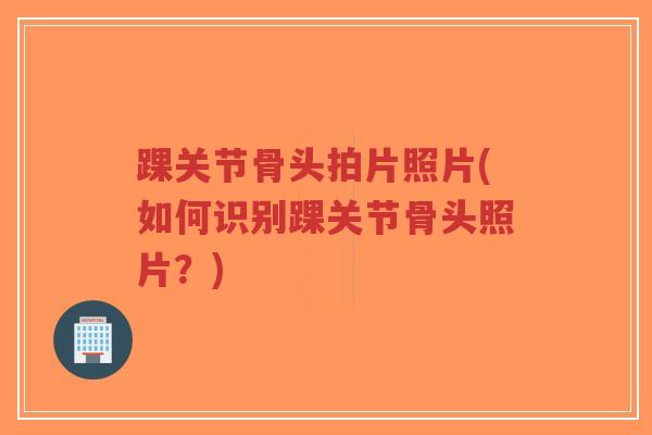 踝关节骨头拍片照片(如何识别踝关节骨头照片?)-第1张图片-超越 踝关节骨头拍片照片(如何识别踝关节骨头照片?)-第1张图片-超越
